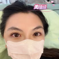 美瞳線完成案例照片