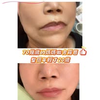 精緻霧唇案例照片